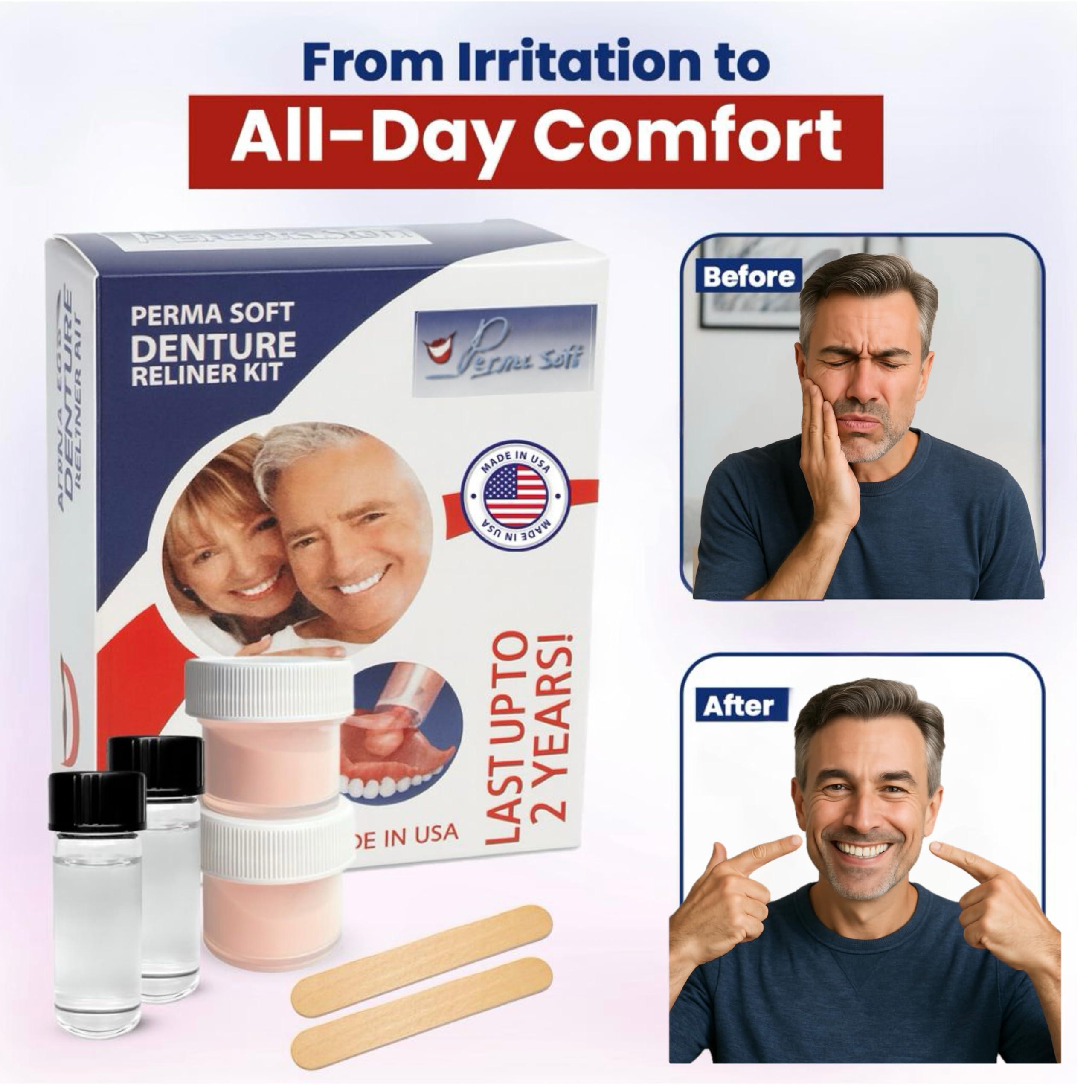 Perma Soft Perma Soft Denture Reliner Kit--Reline 2 Denture Plates