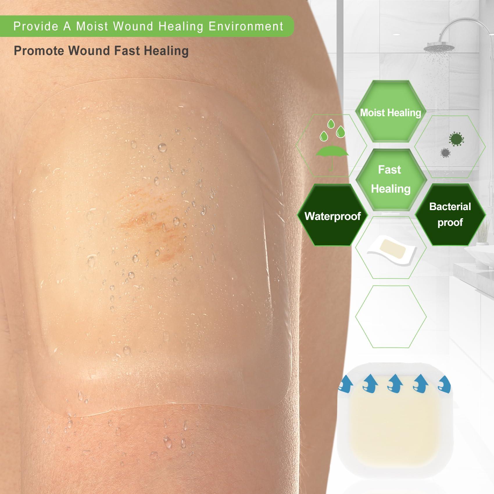 NEUHEILS Hydrocolloid Bandages Hydrocolloid Wound Dressing with Border 4''x4'' for Light to Medium Exudate Wounds, Bed Sore, Pressure Ulcer, Minor Burns, Abrasions, Cuts, Superficial Wound 10 Packs by NeuHeils