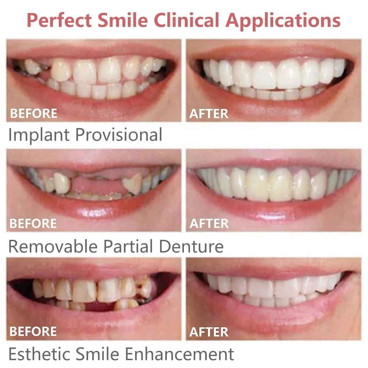 Wttfc 2 Pairs False Teeth Clip in Teeth Instant Perfect Smile Teeth Veneers Comfort Fit Flex Cosmetic Teeth Braces Cover Bad Teeth Top And Bottom for Men And Women Adult