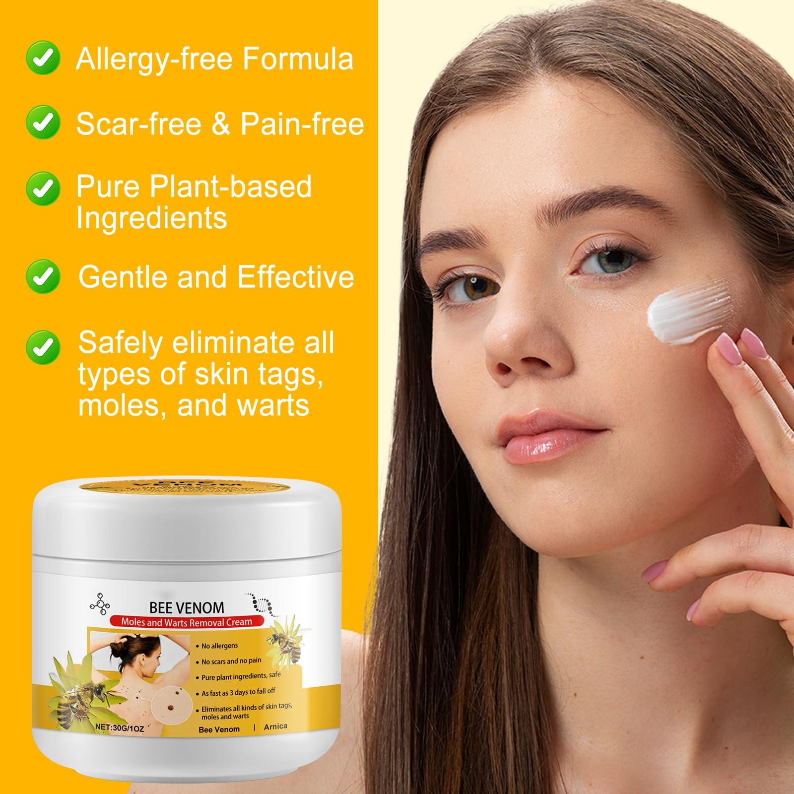 XAYGHE Bee Venom Cream, Bee Venom Wart and Tag Removal Treatment Cream, Hydrating Moisturiser, Removes Spots, Soothes Skin, for All Skins