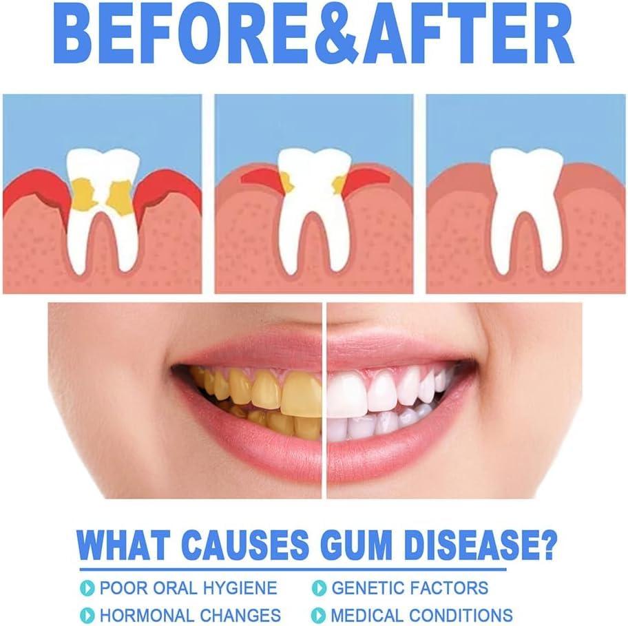 EasPowest Mullend Gum Repair Gel,Mullein Teeth Repair Gel,Qylen Gum Repair Gel, Teeth Whitening Essence Pen, Gum Shield Therapy Gel (5PCS)