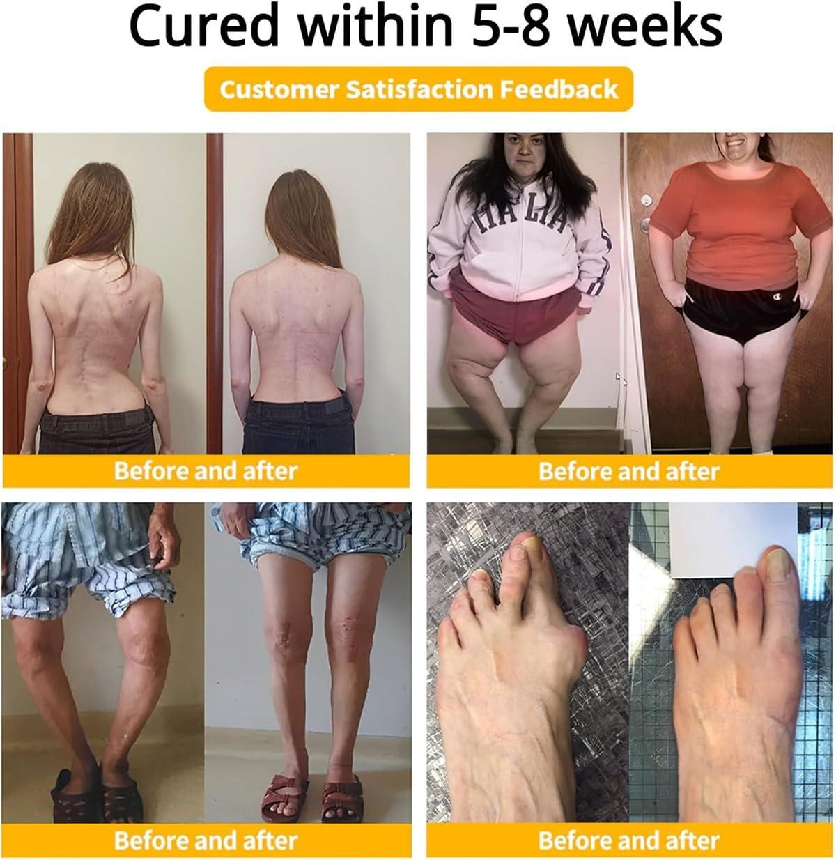 Rietoiu Turanu Bee Venom Turmeric Treatment Cream, Professional Bee Venom Joint Therapy Pain Relief Gel, New Zealand Bee Venom Joint Relief Gel Effective Relief for Back, Neck, Hands, Knee (1 Pcs)