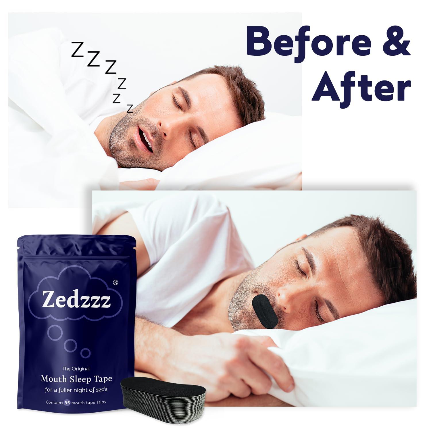 Zedzzz Sleep Zedzzz Mouth Tape for Sleeping (35 Strips) | Anti Snoring Aid for Men & Women | 5+ Weeks of Sleep Tape Strips | Sleep Aid | Anti Snoring Devices Mouth Tape | Snore Stopper | Reusable Mouth Tape