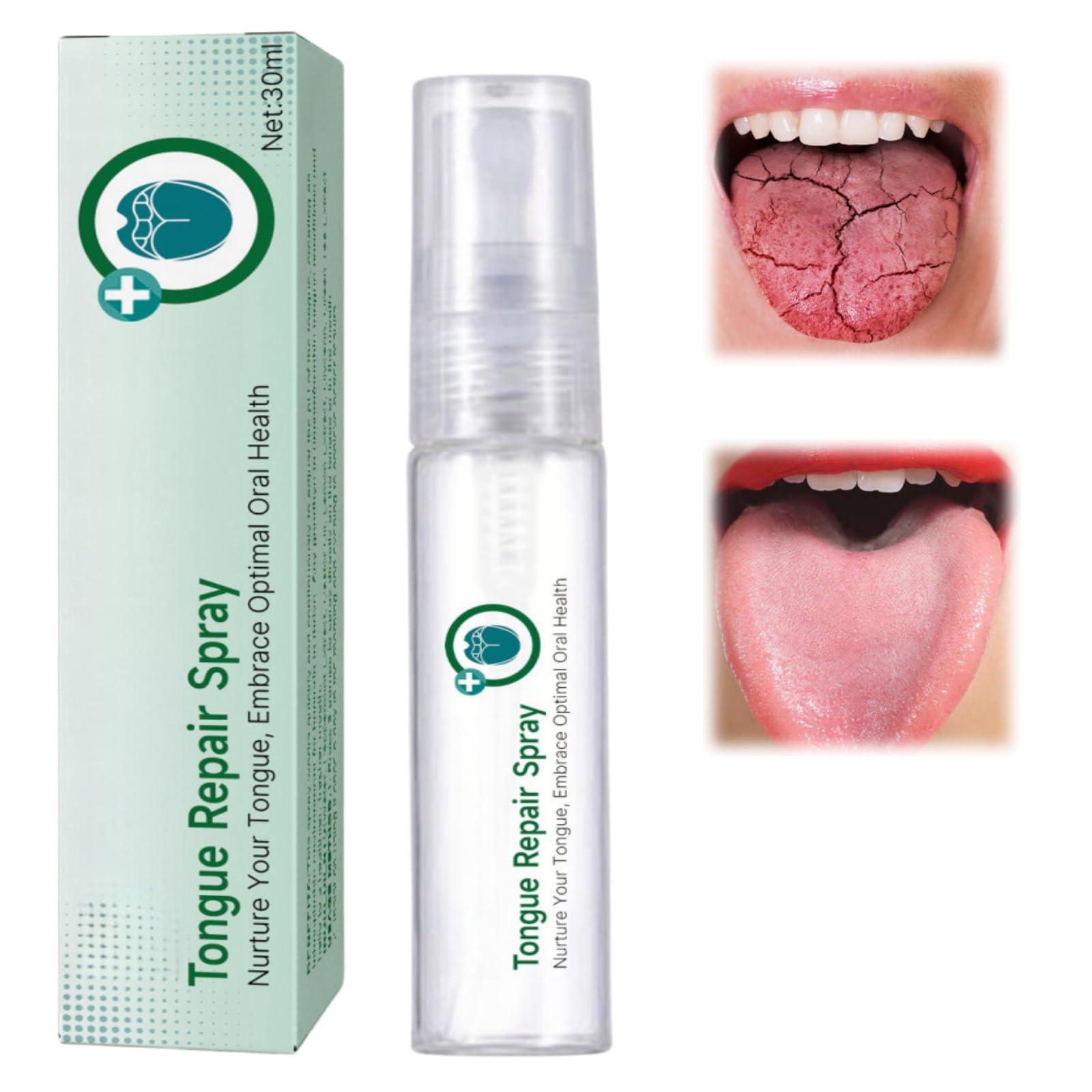 HIVETZ Tongue Repair Spray,Moisturizing Dry Mouth Spray,Fissured Tongue Relief Spray,Instant Dry Mouth Relief,Breath Freshener Spray for Tongue Relief,Tongue Relief Treatment,for White Coating and Bad Breath