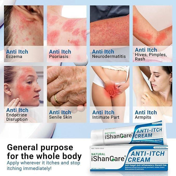 ishancare iShanCare Anti Itch Cream, Maximum Strength Instant Itch Relief for Rash, Eczema, Bug/Mosquito Bites, Psoriasis, Poison Ivy, Dermatitis, Soothing Moisturizer for Dry, Sensitive Skin