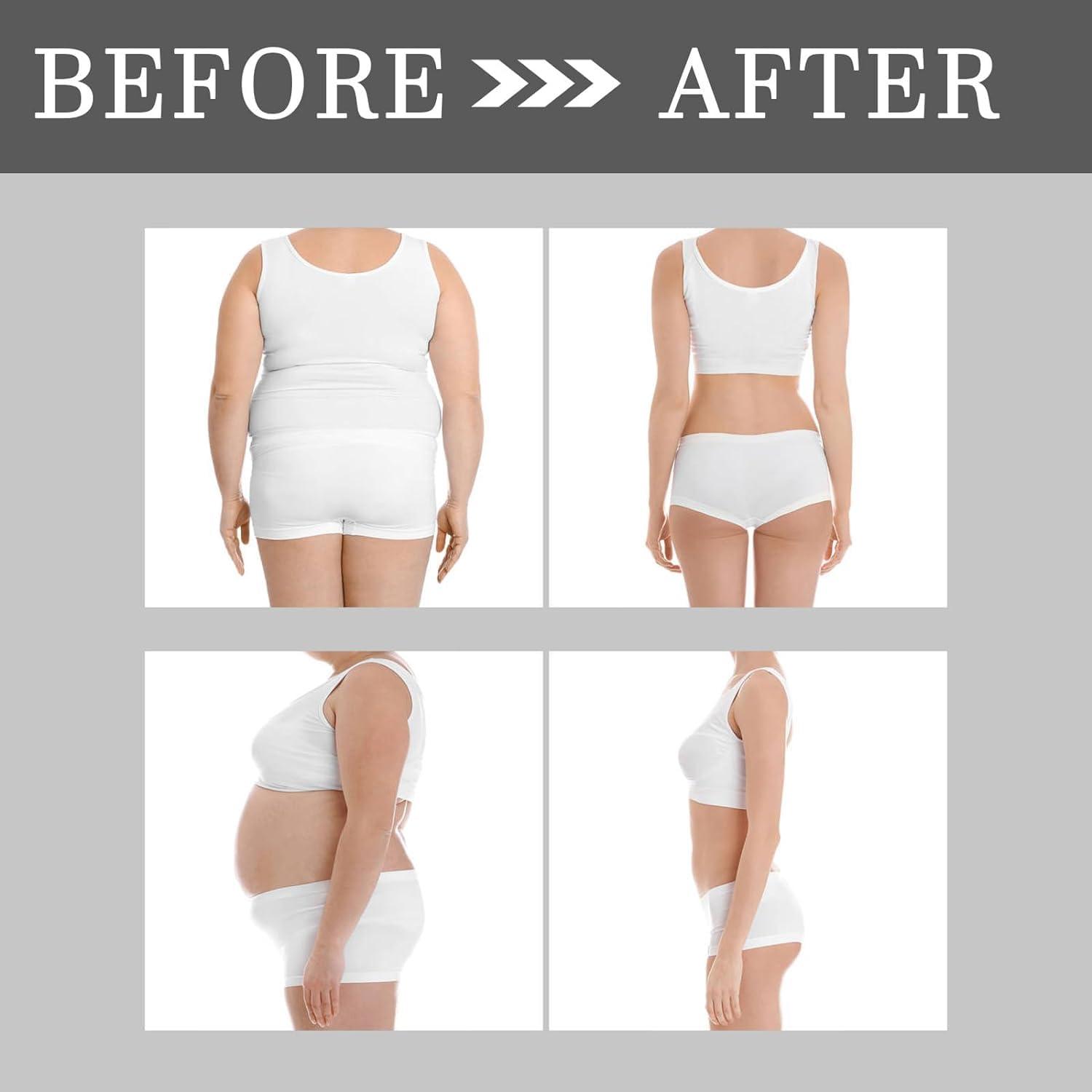 HOIDOKLY Bee Venom, Lymphatic Drainage Bee Venom for Women and Men (2 Pieces)