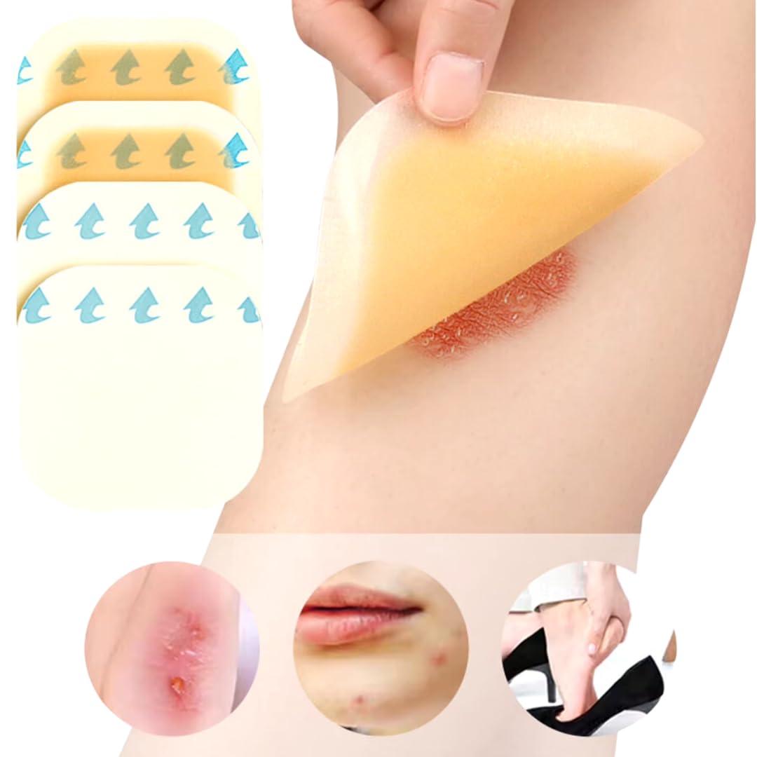 OscarTech UK OscarTech UK Pharmacoll Thin Hydrocolloid Non-Adhesive Dressing 5 x 7.2cm, Pack of 10, for Management of exuding Wounds, Dermal ulcers, Pressure ulcers, Leg ulcers and Diabetic ulcers.