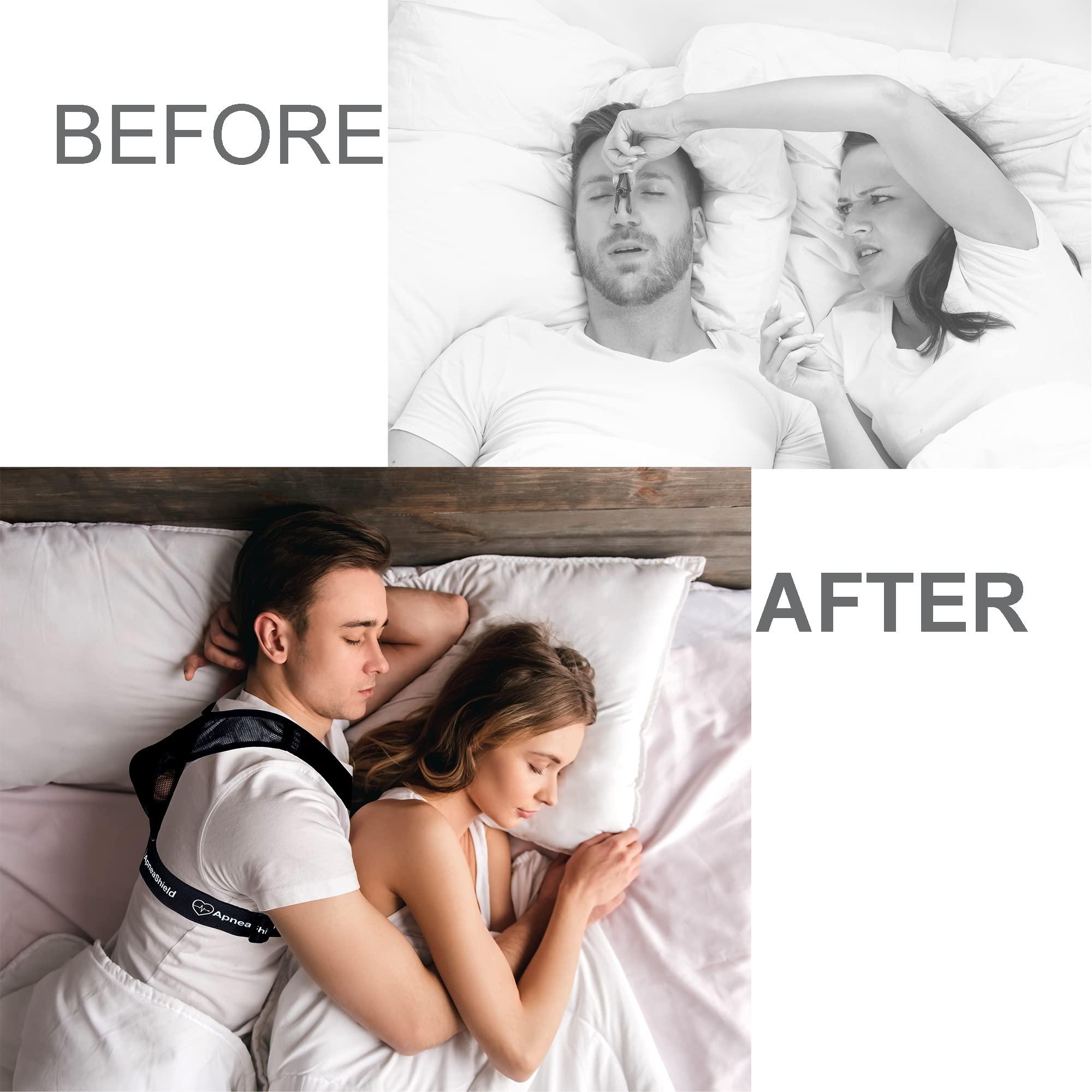 ApneaShield ApneaShield - Sleep Position Trainer for Sleeping On Your Side | Snore Stopper | Anti Snoring Solution | Lightweight, Comfortable, Effective in Reducing Supine Sleep Time
