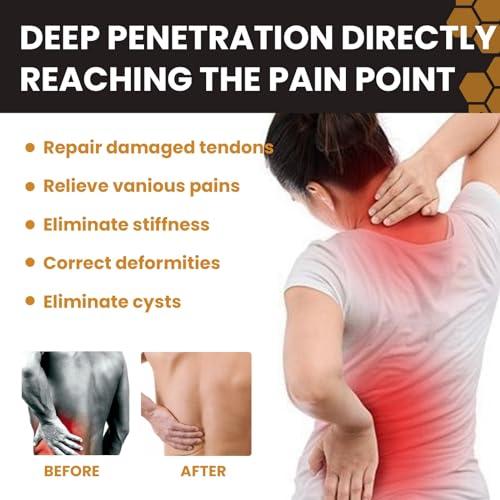 HIVETZ 2PCS New Zealand Bee Venom Joint Relief Gel,Muscle Pain Relief,Bee Venom Professional Treatment Gel,Joint Pain Relief,Bee Venom Joint Soothing Gel,Pain Relief Cream,Muscle Rub Pain Relief,Bee Cream