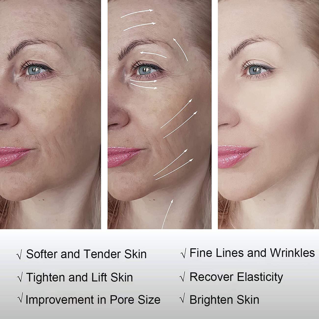 Lnobern ZhiLianZhao Portable Professional Beauty Machine, Anti Aging And Face Skin Care Instrument with 3 Levels Adjustable, Easy to Use, Safe Painless for Wrinkle Reduction & Skin Tightening