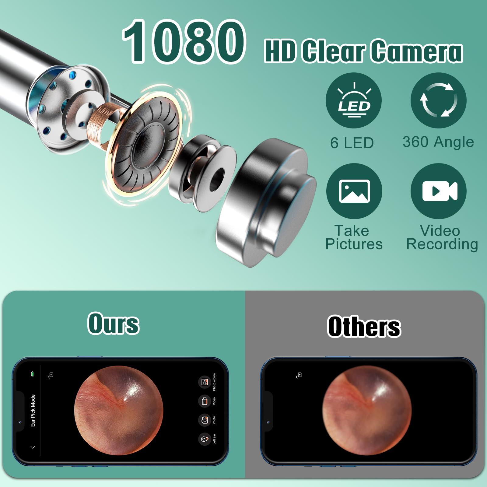 LMECHN LMECHN Ear Wax Removal Kit, Earwax Remover Tool with Camera, Ear Wax Removal with 1080P, Otoscope with LED Light, Ear Camera Otoscope for iPhone, iPad, Android Phones-White