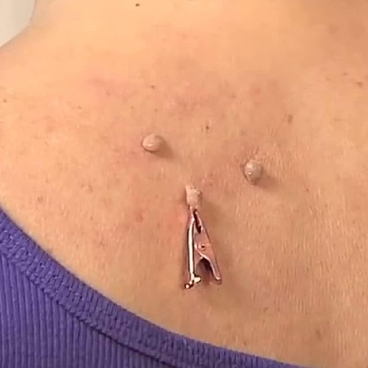 Graootoly Graootoly 1 Box/12Pcs Copper Skin Tag Remover Wart Tag Extractor Copper Tag Out Skin Tag Removal Tool