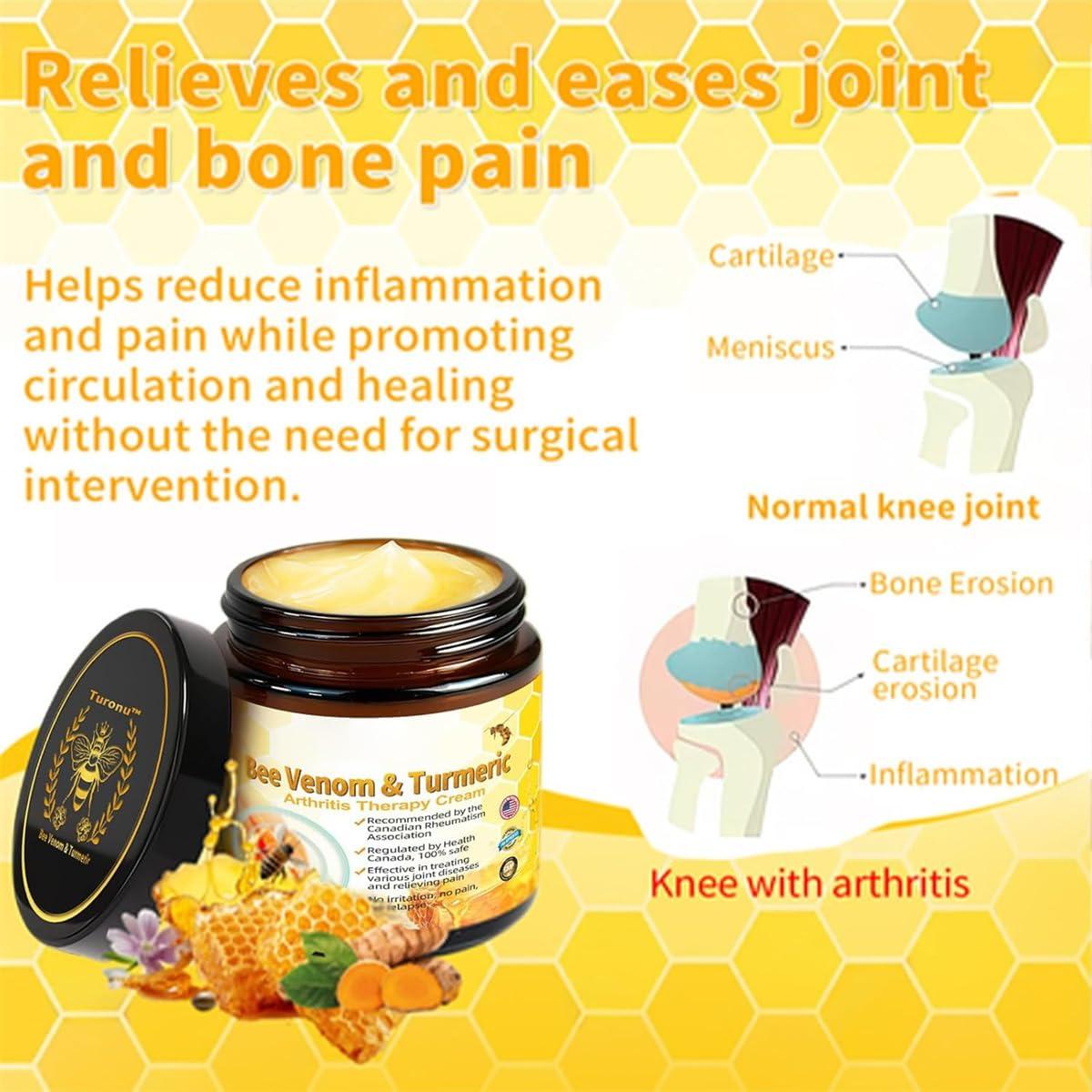 Rietoiu Turanu Bee Venom Turmeric Treatment Cream, Professional Bee Venom Joint Therapy Pain Relief Gel, New Zealand Bee Venom Joint Relief Gel Effective Relief for Back, Neck, Hands, Knee (1 Pcs)