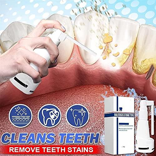 Anshka 30ml Calculusfree Dissolving Dental Spray,Dental Calculus Remover Teeth Cleaner,Mouth Refreshing Spray,Plaque Remover for Teeth Mouthwash,Intensive Stain Removal Toothpaste (2pcs)