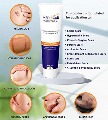 MEDISCAR MediScar Silicone Scar Gel 30g  Keloid Scar Treatment  Hypertrophic Scar Removal Gel- Scar Removal for Face, Body, Stretch Marks, C-Sections, Surgical Marks, Acne  Old and New Scars