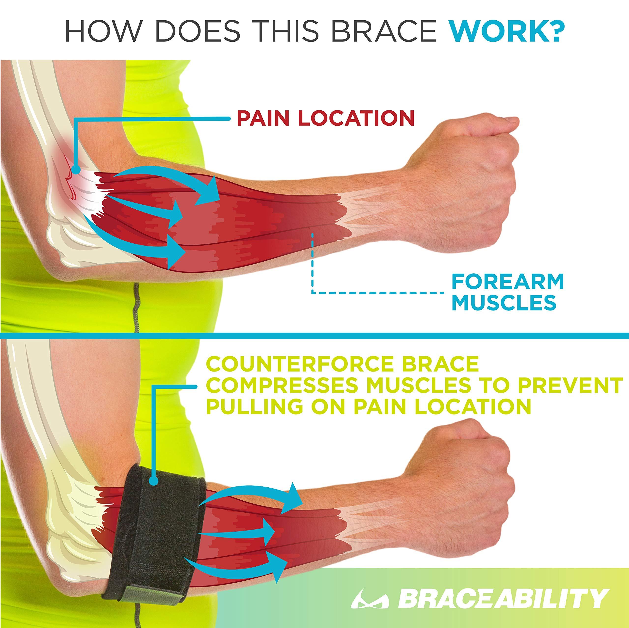 BraceAbility BraceAbility Counterforce Brace - Tendonitis Strap Support Band for Tennis & Golfers Elbow Pain