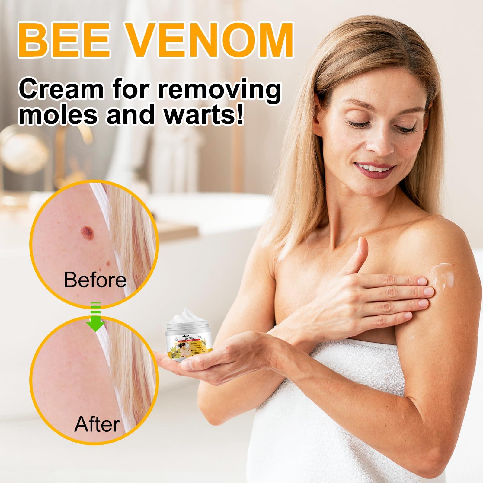 XAYGHE Bee Venom Cream, Bee Venom Wart and Tag Removal Treatment Cream, Hydrating Moisturiser, Removes Spots, Soothes Skin, for All Skins