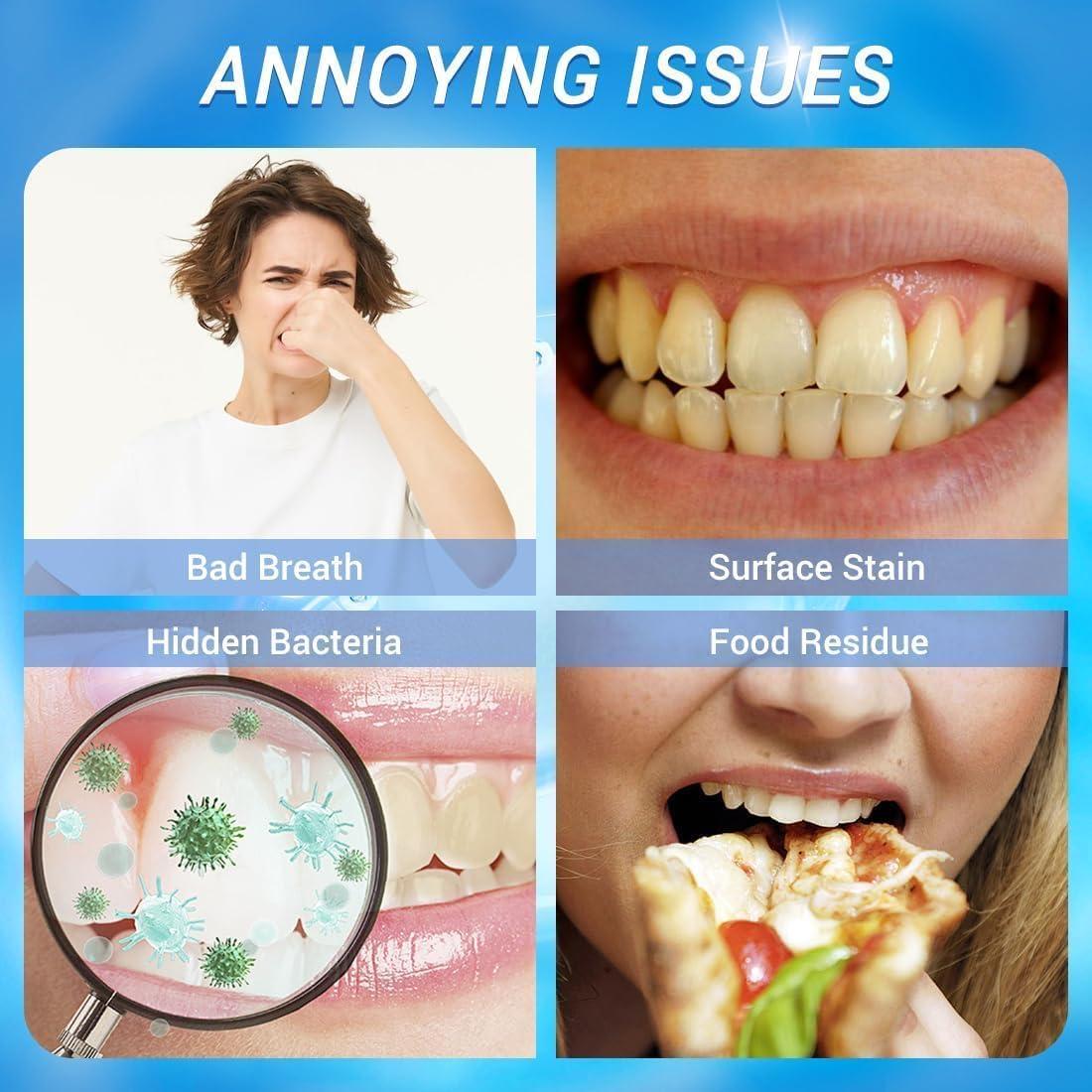 Sovtay Xoermioy Niacinamide Whitening Toothpaste, Bodyaccel Niacinamide Whitening Toothpaste, Bodyaccel Niacinamide Toothpaste, Dazzle White Toothpaste, Remove Stain and Whitening (3PCS)