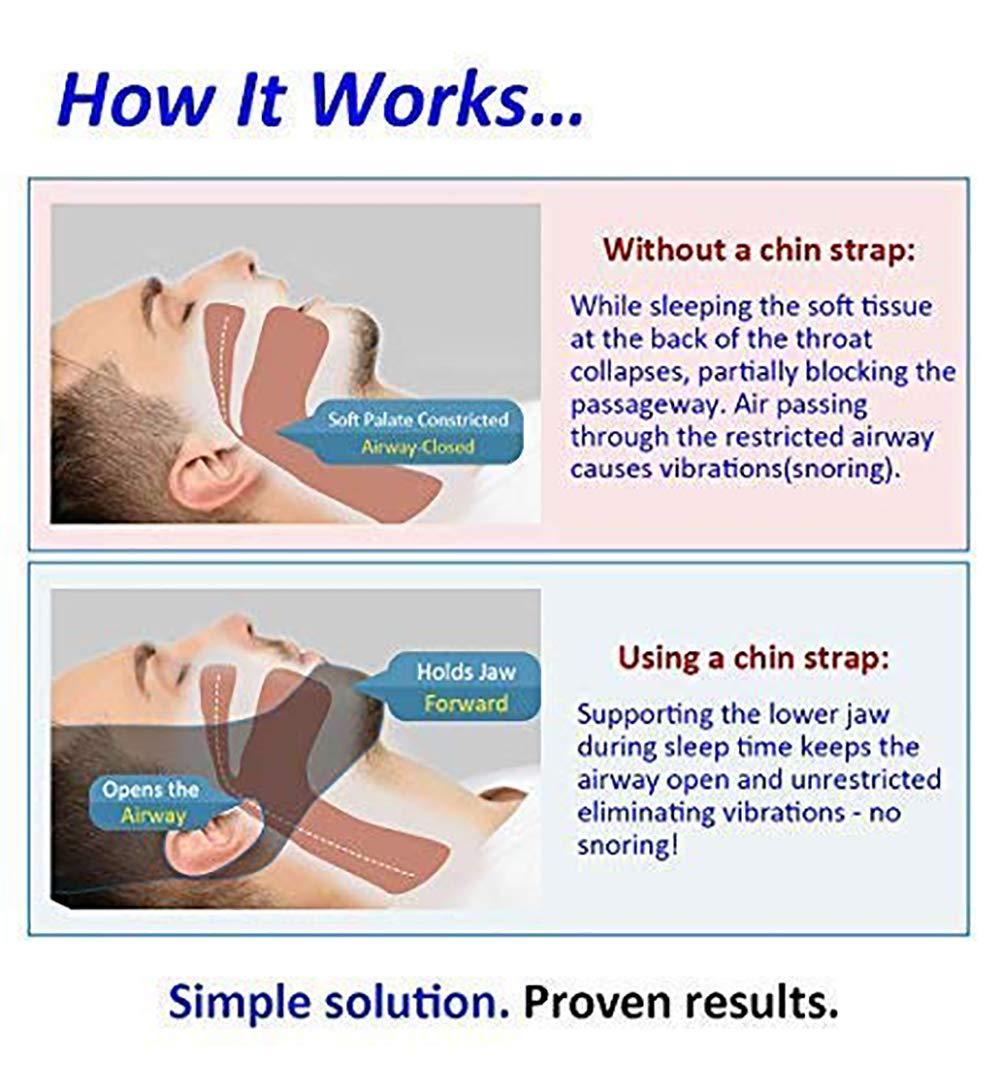 BETTER ANGEL LE Anti Snore Snoring Chin Strap Devices for Men Women Kids, Anti My Snoring Snore Solution, Resmed Cpap Supplies Chin Straps, Cpap Chin Strap XL Pads Respironics, Anti Snoring Snore Chin Strap Large