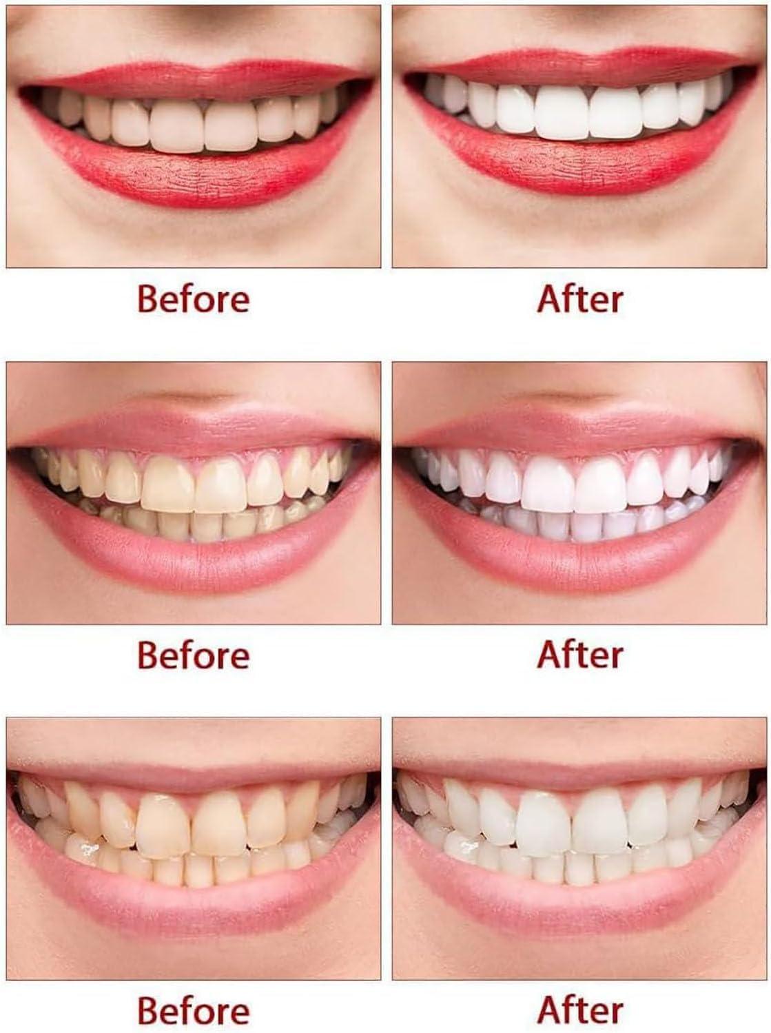 Giurui Larineco Toothpaste, Nano Hydroxyapatite Natural Remineralizing Toothpaste, Remineralizing Gum Chewing Gum Toothpaste, Organic Mastic Mint Toothpaste Gum, Tooth Care and Fresh Breath (2 Pcs)