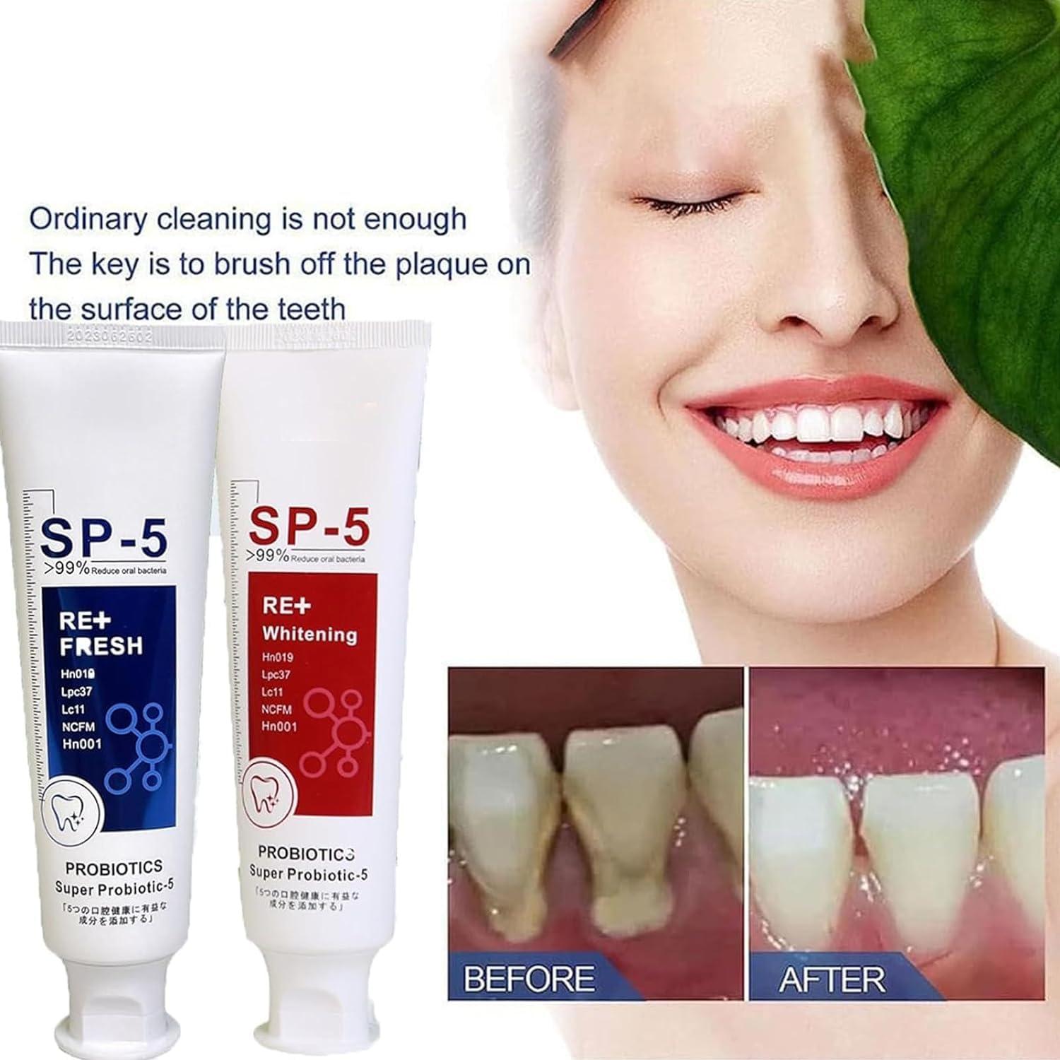 Kolarmo Sp-5 Toothpaste,Sp 5 Tooth Whitening,Whitening Toothpaste Sp 5,We2c Whitening Toothpaste Teeth Sp-5,New Upgrade Sp 5 Ultra Whitening Probiotic Toothpaste (Blue)
