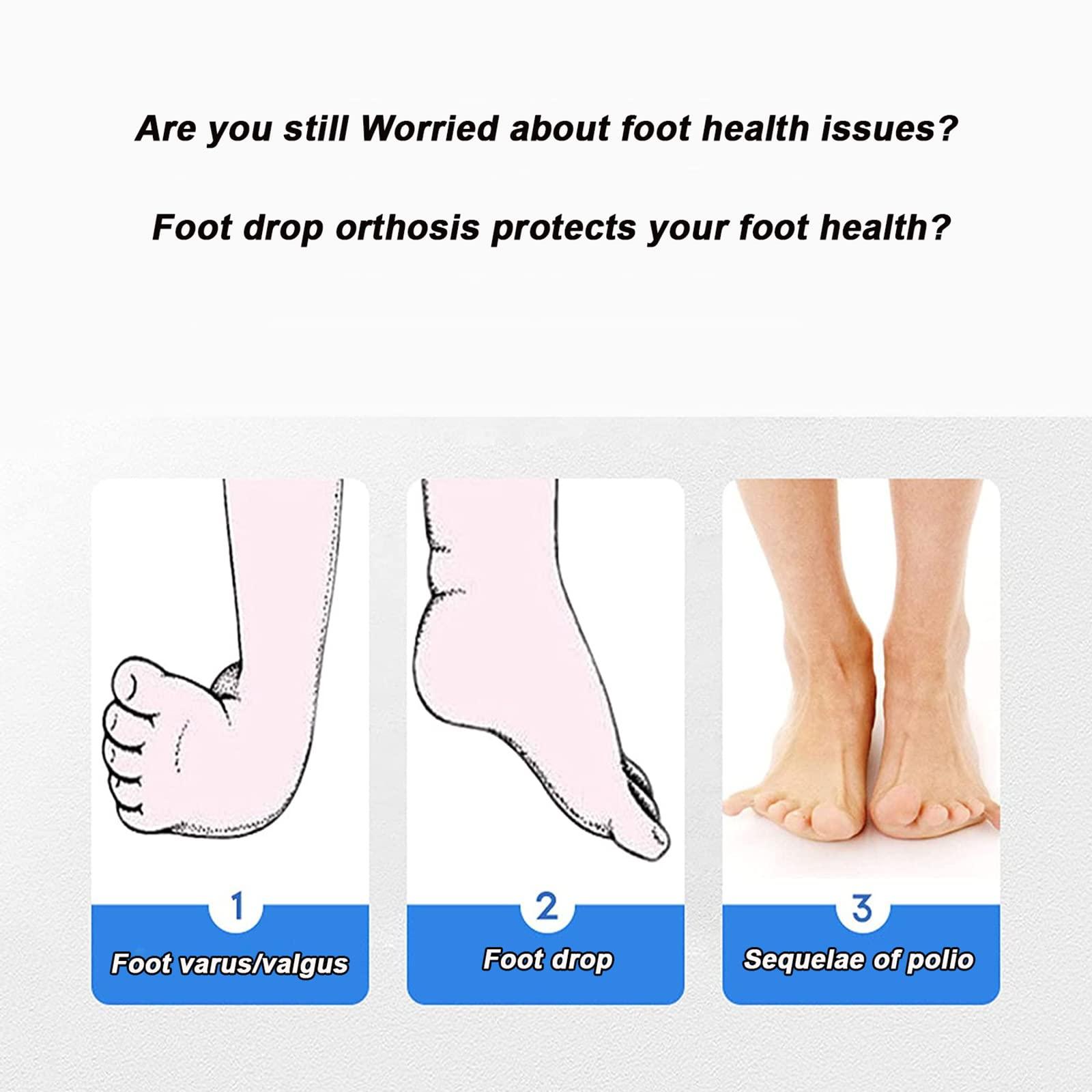 FreshCart Basics Foot Drop Brace,Foot Drop Orthosis, Adjustable AFO Ankle Orthosis Splint Support, Drop Foot Brace Orthosis, for Foot Drop Plantar Fasciitis Achilles Tendonitisi