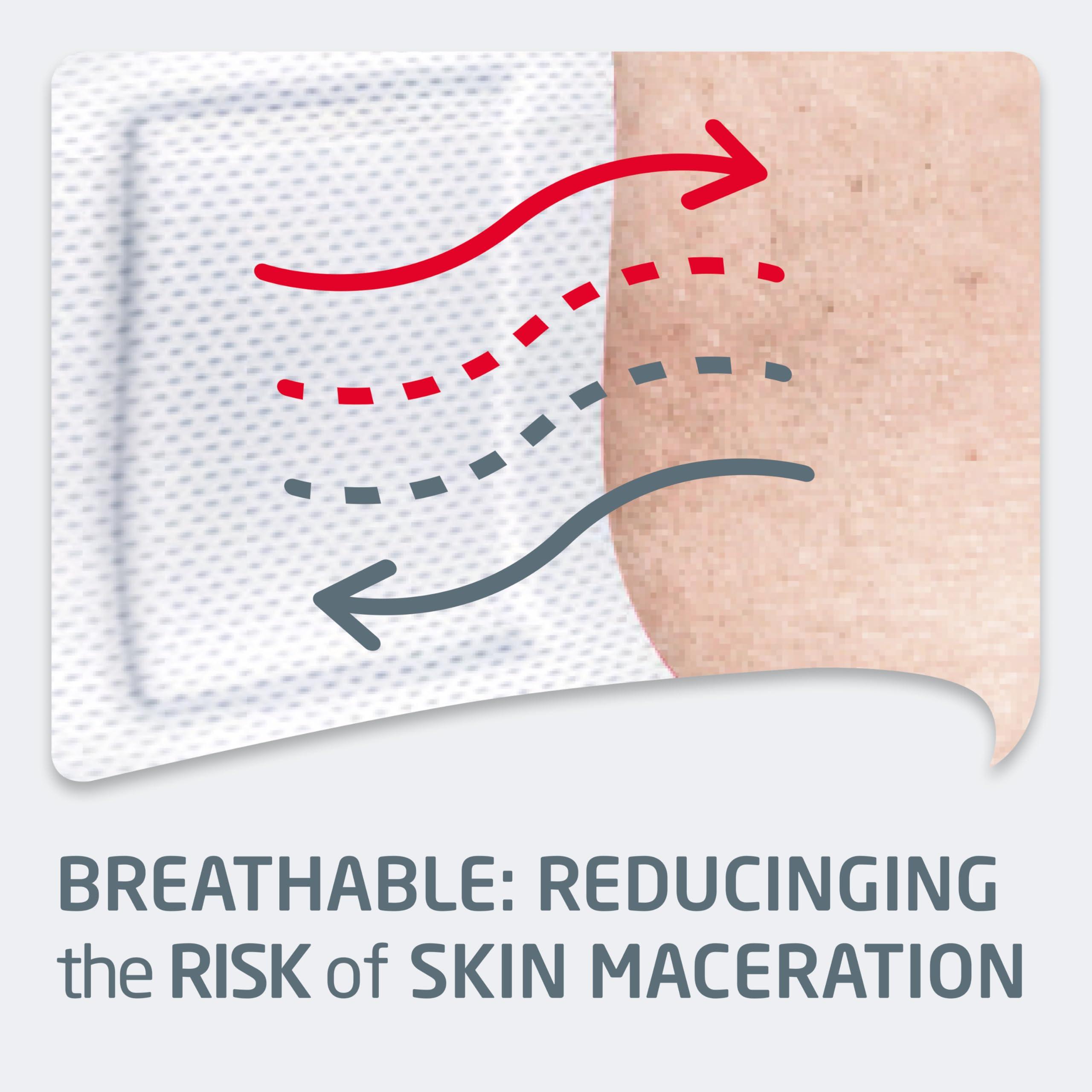 Leukoplast Leukoplast Soft White - Non-Sterile Wound Dressing Strips - Skin-Friendly, Breathable and Absorbent, First-aid Plasters - White - 2 Assorted Sizes - Box of 30