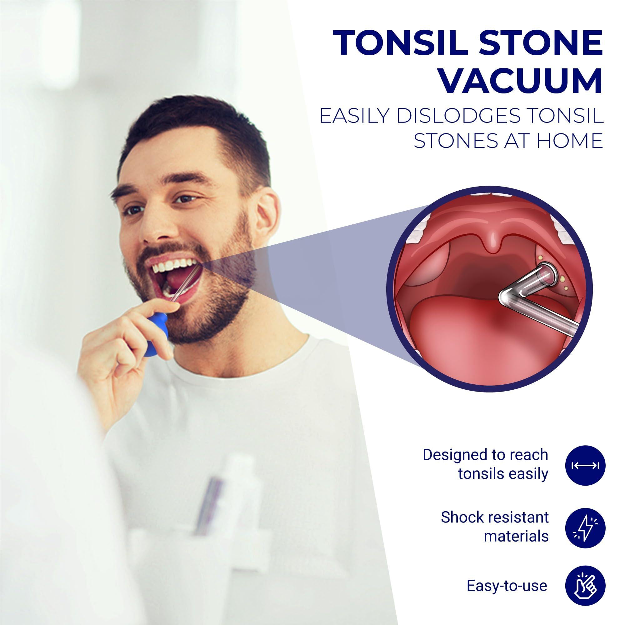 ORAVIX Oravix Tonsil Stone Remover Vacuum, Tonsil Stone Remover for Bad Breath Treatment, Tonsil Stone Suction Tool, Tonsil Stones Remover, Tonsil Stone Remover Vacuum Pump, Tonsil Stone Vacuum