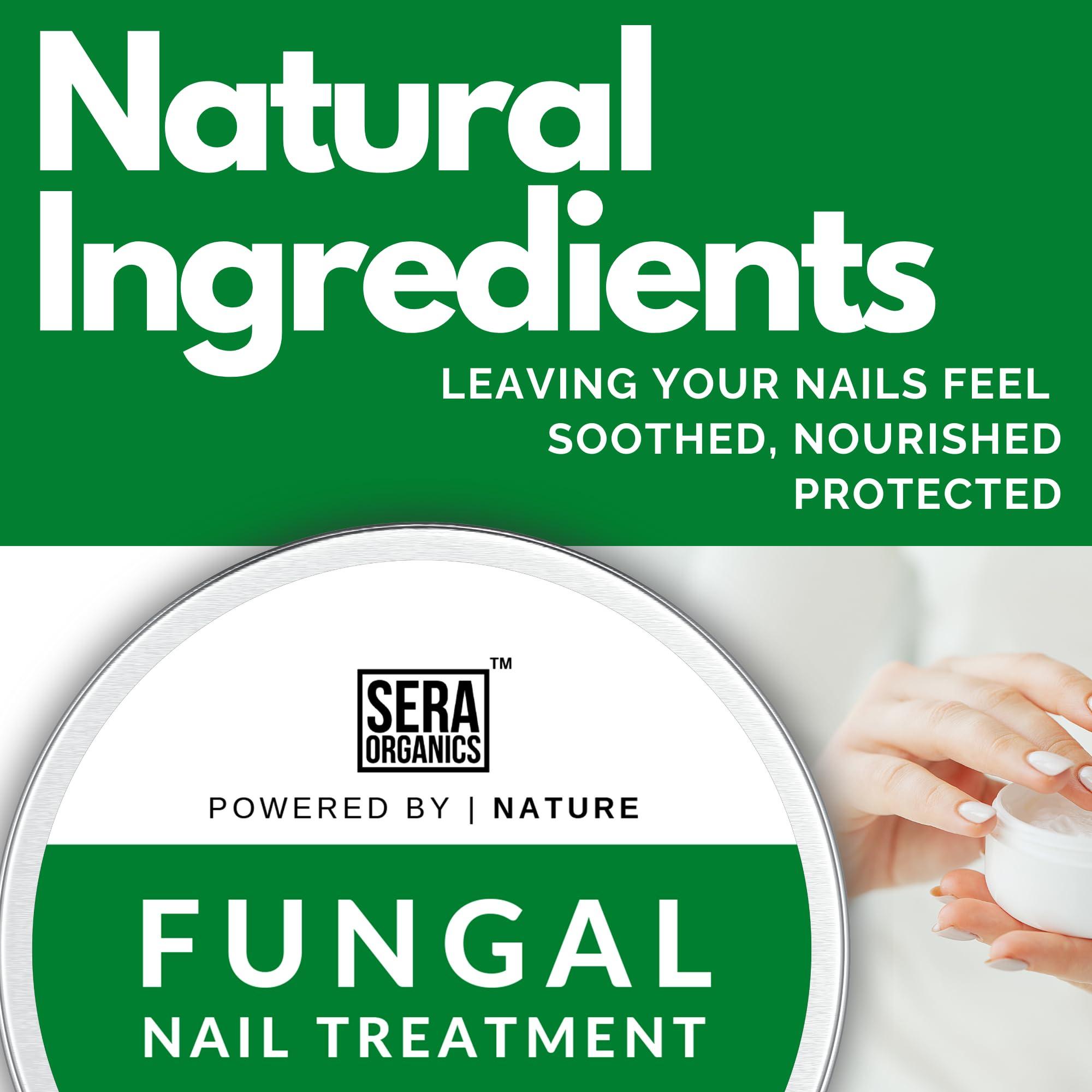 Sera Organics Fungal Nail Treatment Cream - Antifungal Ingredients Natural Strong Anti-Fungal Nail Treatment For Toenail Fungus, Foot Cream With Nourishing Oils For Nail Growth & Nail Repair (30ml) By Sera Organics