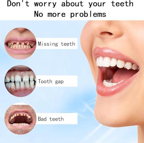 Qklovni Silicone Reline Denture Set, Silicone Denture Set, Silicone Denture Kit, Soft Silicone Denture Reline Kit, Silicone Reline for Perfect fit Dentures (1pcs)