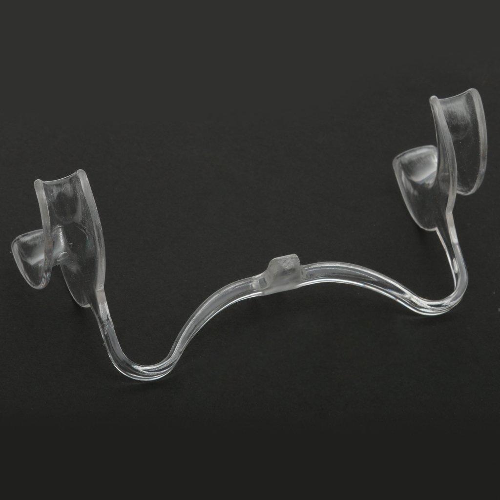 Tiuimk Tiuimk Transparent U-Shaped Dental Cheek Retractor - Medium Size for Clear Oral View