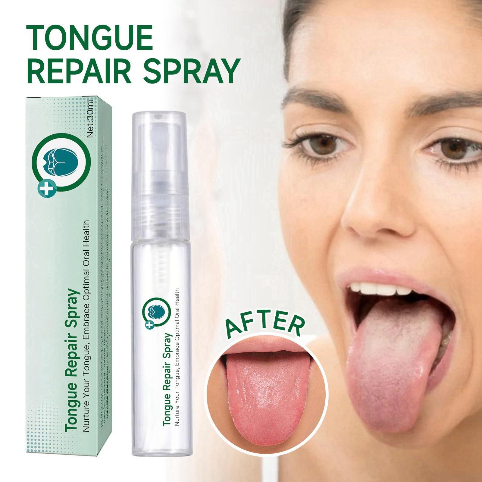 HIVETZ Tongue Repair Spray,Moisturizing Dry Mouth Spray,Fissured Tongue Relief Spray,Instant Dry Mouth Relief,Breath Freshener Spray for Tongue Relief,Tongue Relief Treatment,for White Coating and Bad Breath