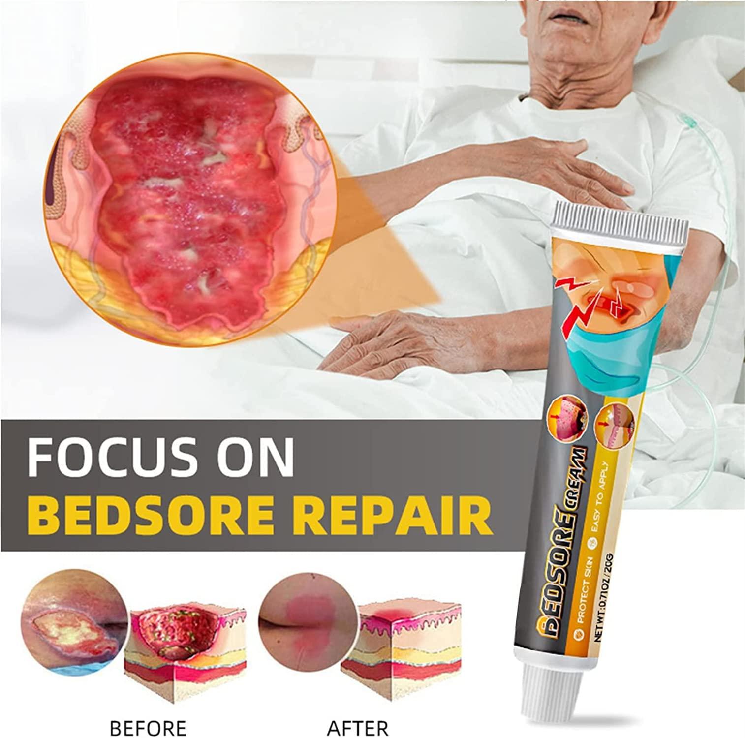 Eeiiey Bed Sore Treatment Cream,Bed Sores Healing Cream,Pressure Sore Relief Cream (1 Pcs)