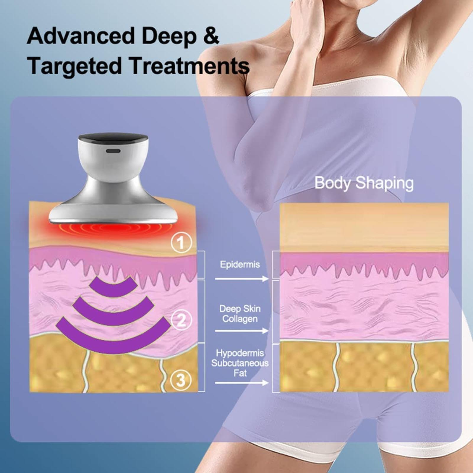 MWSHIYUQING MWSHIYUQING Cellulite Treatment Machine, Lightweight Body Fat Eliminator Machine Belly Smoother Leg Cellulite Remover, For Human Skin