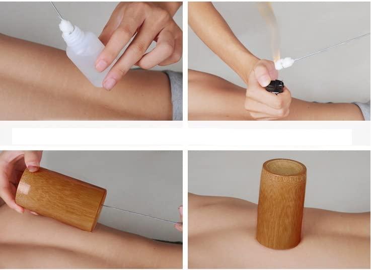 Ecoodisk Ecoodisk 20pcs Boiled Bamboo Massage Cupping Set Carbonized Bamboo For Traditional Vacuum Cupping Acupuncture Fire Therapy Tools