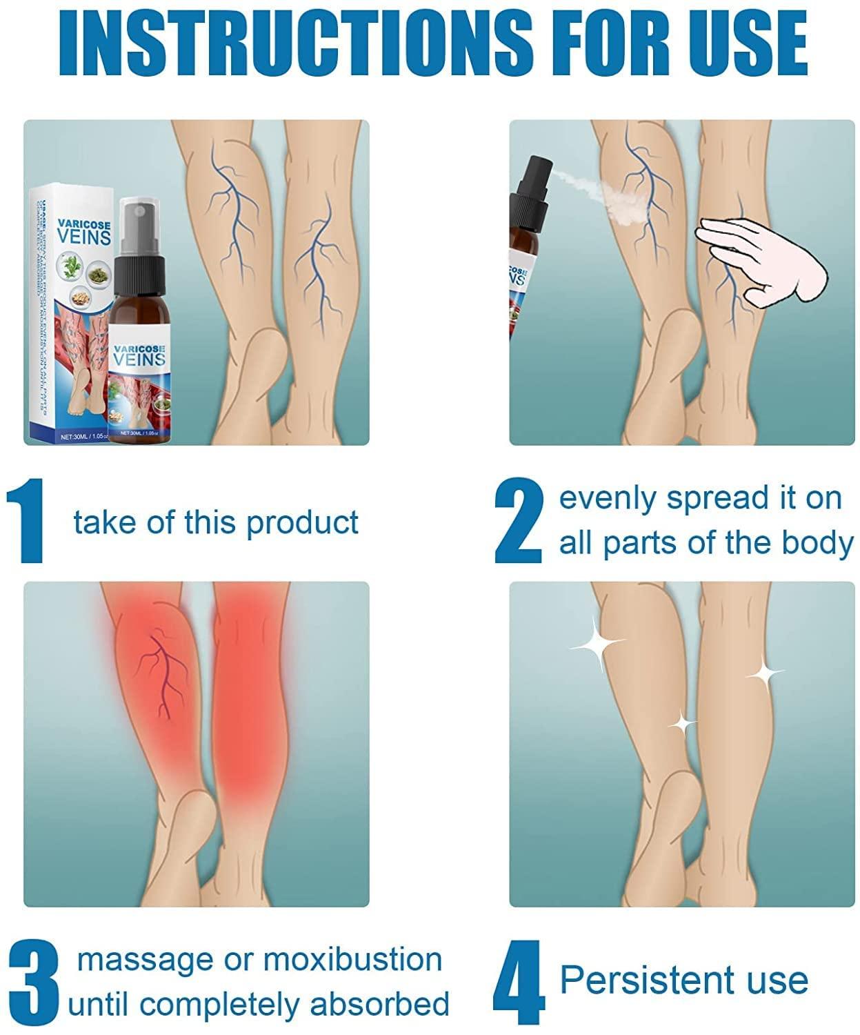 Anshka Varicose Veins Spray,Varicose Veins Care Spray,Veinhealing Varicose Veins Treatment Spray,for Legs Improve Blood Circulation,Relief Phlebitis Angiitis Varices Inflammation (1pcs)