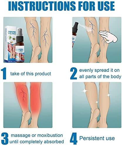 Anshka Varicose Veins Spray,Varicose Veins Care Spray,Veinhealing Varicose Veins Treatment Spray,for Legs Improve Blood Circulation,Relief Phlebitis Angiitis Varices Inflammation (1pcs)
