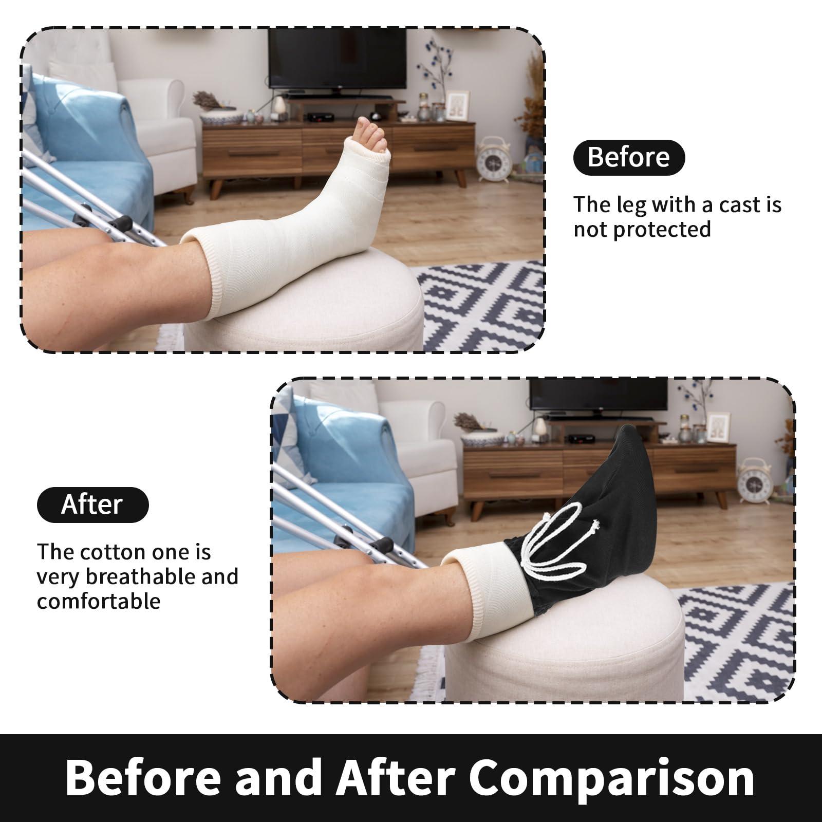Prasacco Prasacco Cast Sock Cover for Foot, Cast Toe Cover Socks Leg Cast Cover Below the Knee Adjustable Drawstring Cast Protector Washable Cast Sleeve for Men Women Foot Leg Ankle Proof, Black