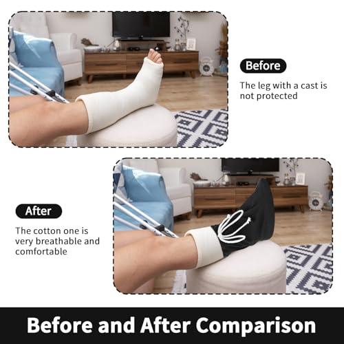 Prasacco Prasacco Cast Sock Cover for Foot, Cast Toe Cover Socks Leg Cast Cover Below the Knee Adjustable Drawstring Cast Protector Washable Cast Sleeve for Men Women Foot Leg Ankle Proof, Black