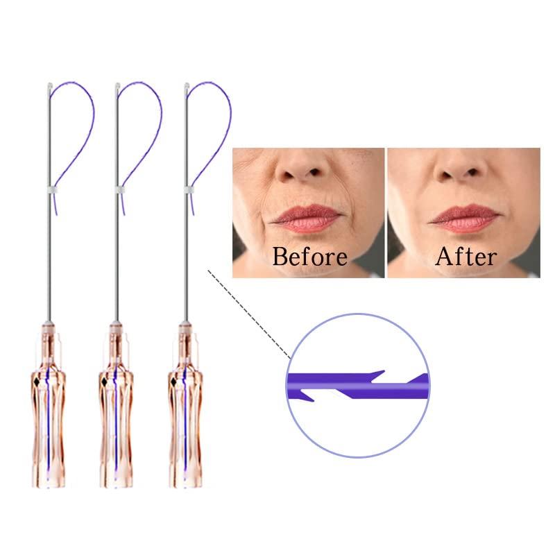 Firmosa Pdo Cog Threads(molding s 19g 100mm), Pdo Molding Threads, Pdo Korea Lift, Pdo Threads Cog For Breast, 100mm Threads Cog Pdo(20PCS)