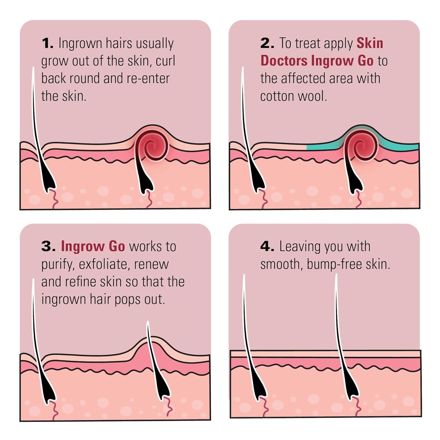Skin Doctors Skin Doctors Ingrow Go Lotion x 3