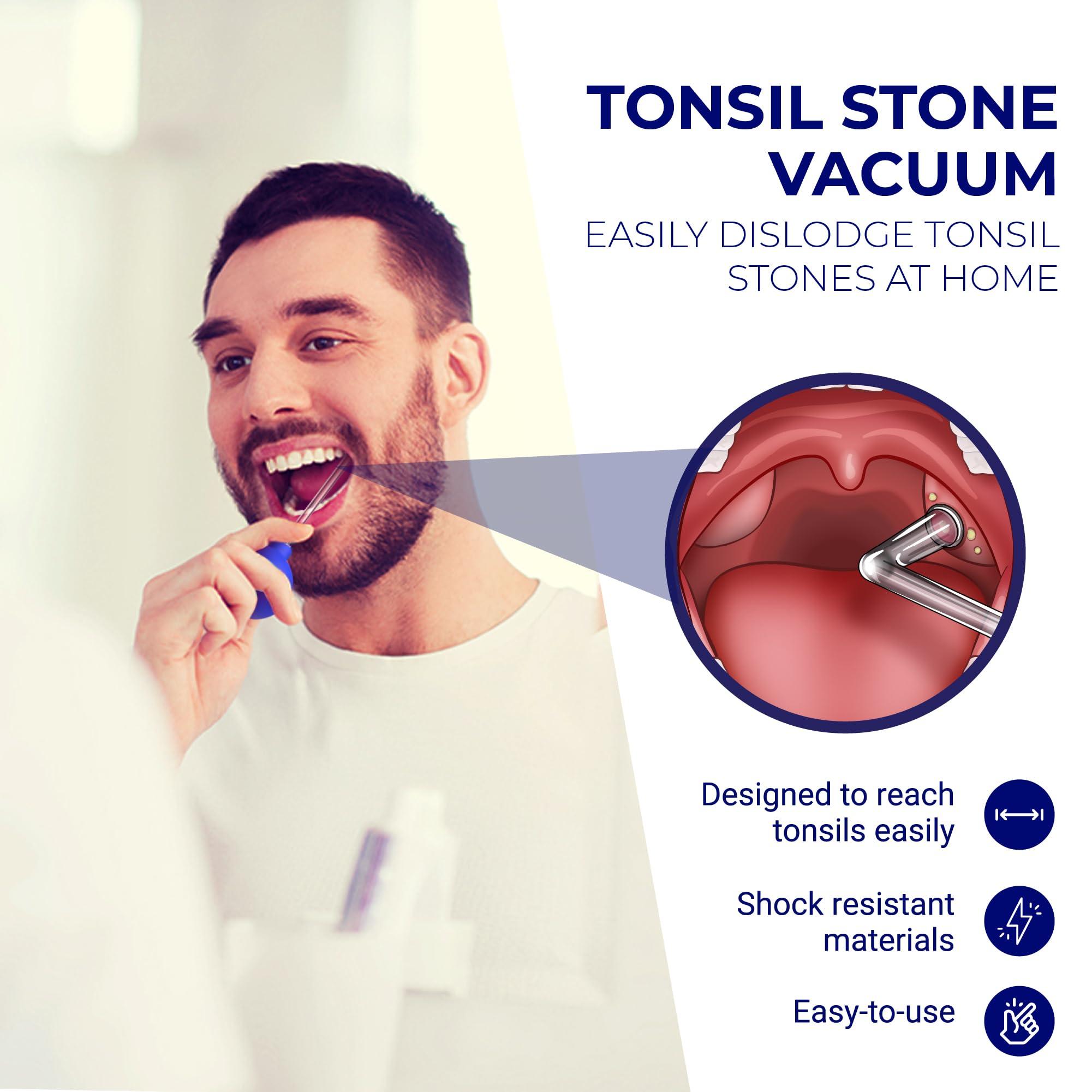 ORAVIX Oravix Tonsil Stone Remover Vacuum, Tonsil Stone Remover for Bad Breath Treatment, Tonsil Stone Suction Tool, Tonsil Stones Remover, Tonsil Stone Remover Vacuum Pump, Tonsil Stone Vacuum