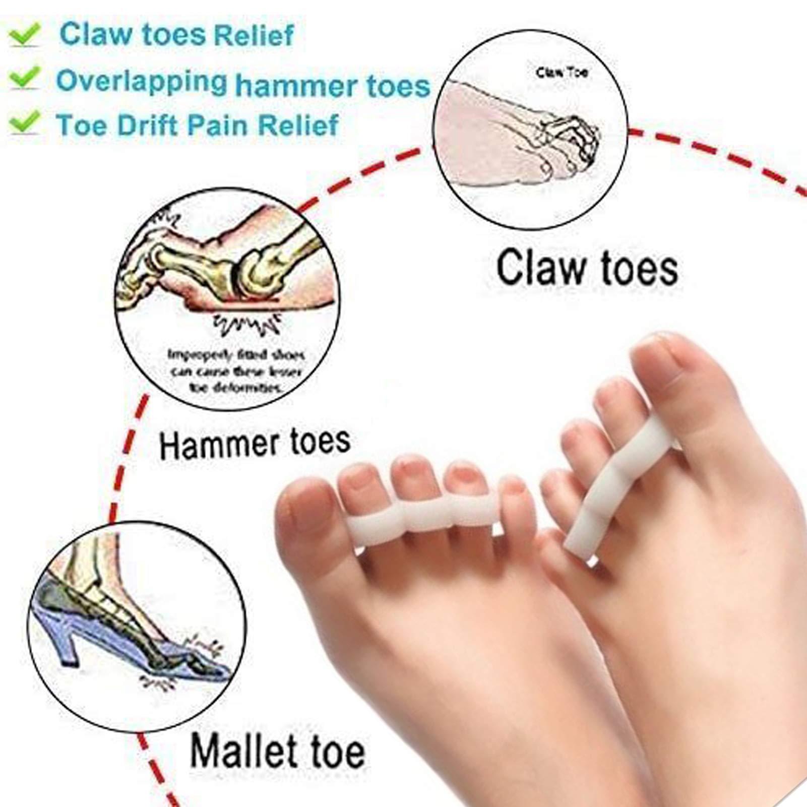 Mcvcoyh Mcvcoyh Gel Hammer Toe Crests Pads x 10 Pcs Silicone Toe Cushion Support for Hammer Toe, Overlapping Toes, Curled Toe-3 Loops