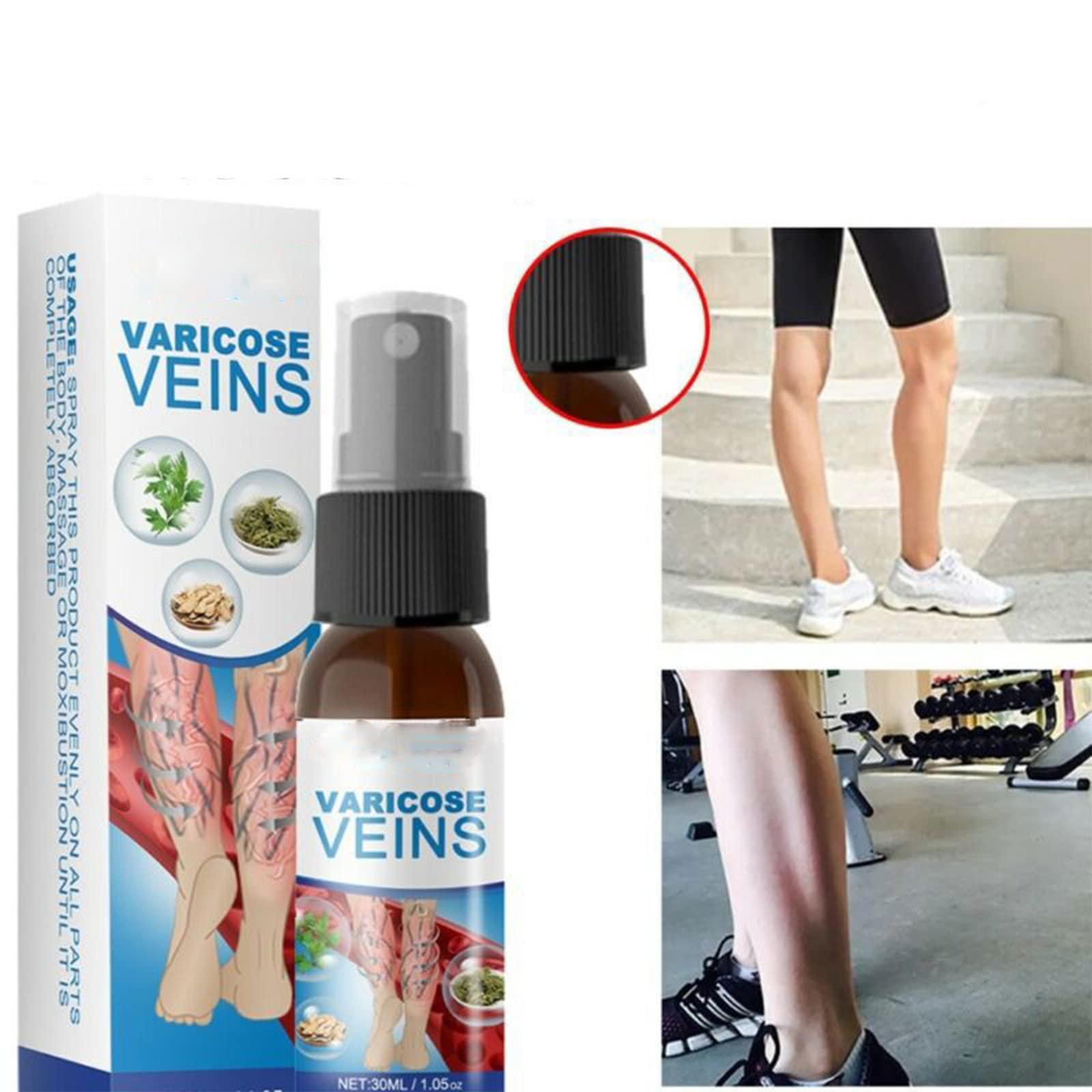 Anshka Varicose Veins Spray,Varicose Veins Care Spray,Veinhealing Varicose Veins Treatment Spray,for Legs Improve Blood Circulation,Relief Phlebitis Angiitis Varices Inflammation (1pcs)