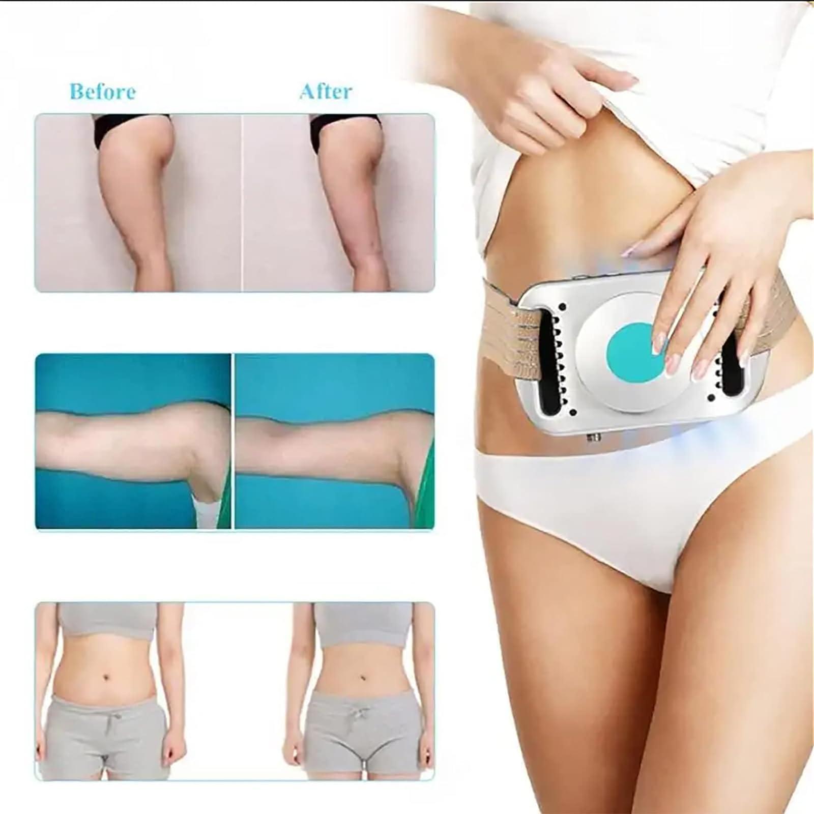 McbeAn Freezing Fat Removal Machine, Portable Cryolipolysis Instrument, Lipolysis Substance and Cold Freeze Fat Massage, for Slimming Tummy, Arms, Thighs, Shanks, Lifting Hips