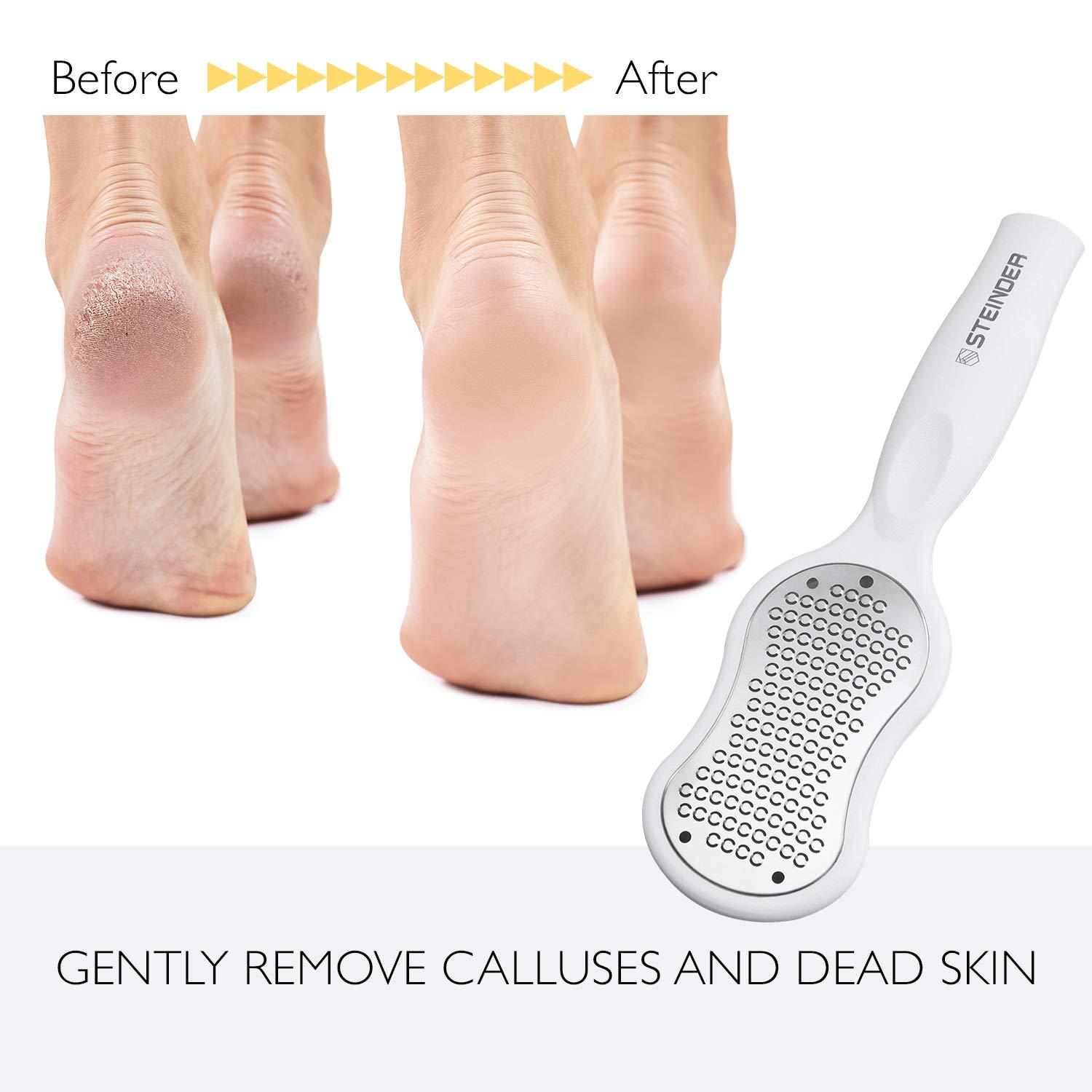 STEINDER Steinder Foot File for Hard Skin Remover, Foot Scrubber Scraper, Feet Pedicure Kit, Foot Grater, Heel File, Foot Care Kit - White