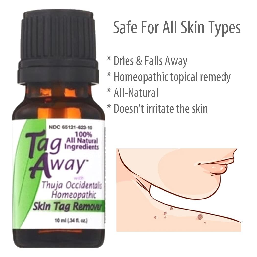 Tag Away Tag Away Skin Removal, 10mL (0.34 fl. oz.)