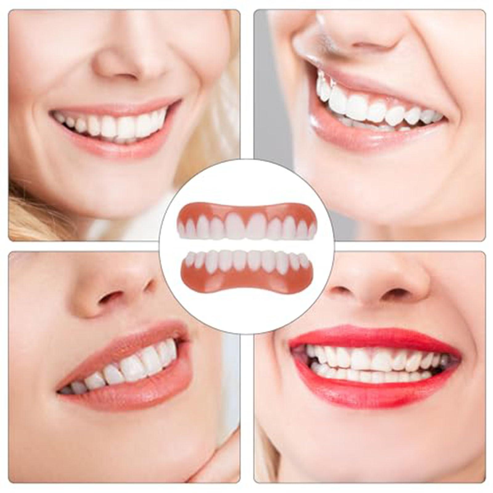 Brigtviee Brigtviee Silicone Reline Denture Set, 2 Pair of Snap-On Dentures Set Upper & Lower,Veneers Snap in Teeth Teeth Comfort Fit, for Men Women with Bad Teeth