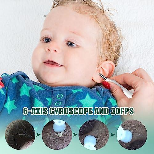 LMECHN LMECHN Ear Wax Removal Kit, Earwax Remover Tool with Camera, Ear Wax Removal with 1080P, Otoscope with LED Light, Ear Camera Otoscope for iPhone, iPad, Android Phones-White