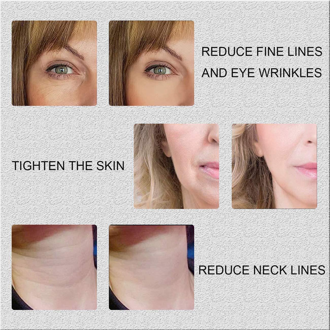 Lnobern ZhiLianZhao Portable Professional Beauty Machine, Anti Aging And Face Skin Care Instrument with 3 Levels Adjustable, Easy to Use, Safe Painless for Wrinkle Reduction & Skin Tightening